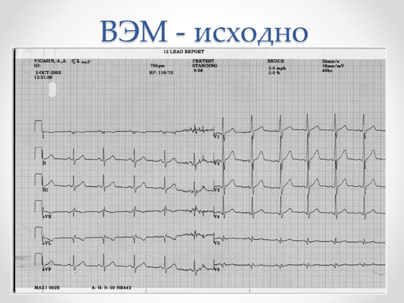 ВЭМ - исходно ВЭМ - исходно